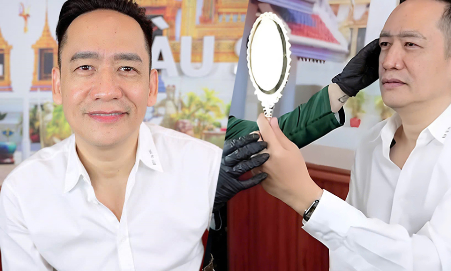 Duy Mạnh bất ngờ đi phun môi, mở  cung chân mày: Thấy chị em làm đẹp quá nên tôi cũng muốn thử