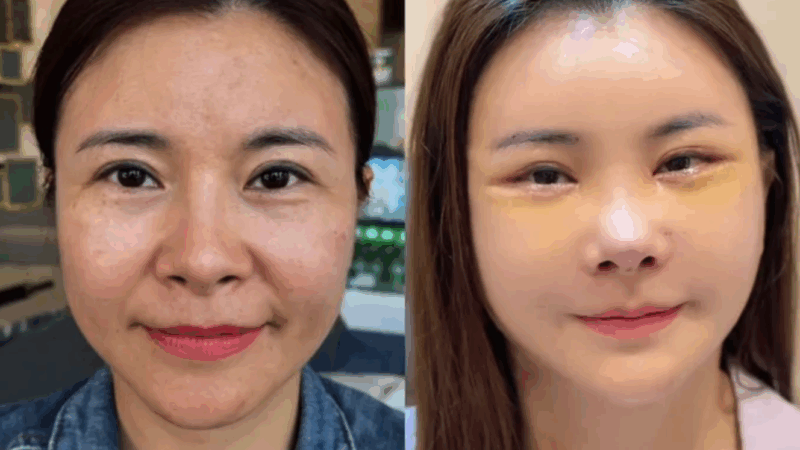 Mỹ nhân U50 từng bị gh:ét cay gh:ét đắng trên phim tiết lộ lý do “đ:ập mặt làm lại từ đầu”: Muốn bớt á:c trong mắt khán giả?