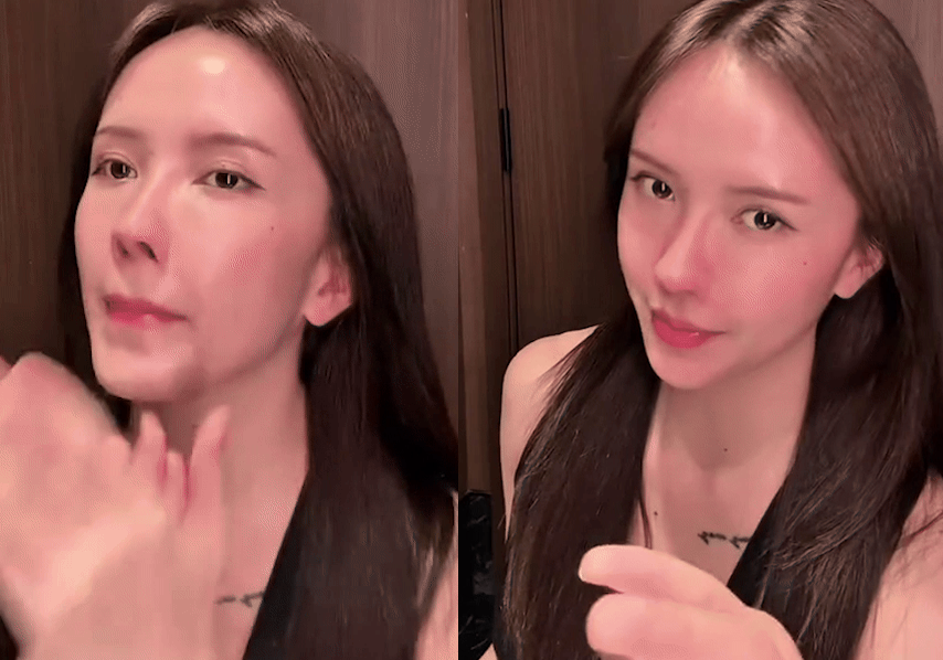 Thiều Bảo Trâm lộ bi:ến ch:ứng hậu d:ao k:éo: Fan hoang mang lo lắng