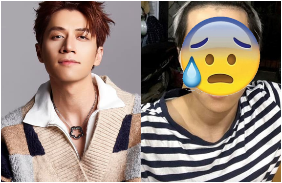Anh Trai Say Hi’ bị tai nạn liệt nửa mặt, ngoại hình biến dạng khiến ai nhìn cũng bàng hoàng