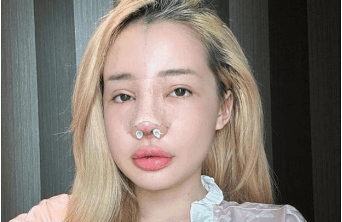 Thực hư thông tin bác sĩ Chiêm Quốc Thái là người làm bi:ến dạ:ng mũi của Ngân 98, người trong cuộc đã lên tiếng: “Hóa ra là như vậy”