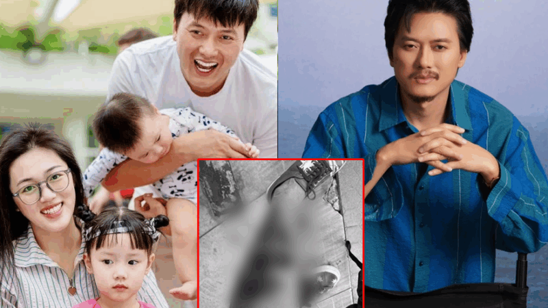 Quách Ngọc Tuyên gặp tai nạn khiến fan lo lắng: Hình ảnh vết thương khiến ai nhìn cũng rùng mình