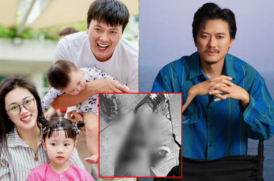 Quách Ngọc Tuyên gặp tai nạn khiến fan lo lắng: Hình ảnh vết thương khiến ai nhìn cũng rùng mình