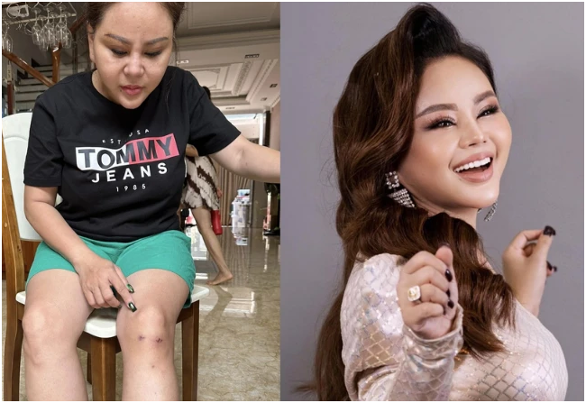 Lê Giang một mình chố:ng ch:ọi với căn bệ:nh l:ạ: “Bất lực khi lế:ch vào nhà tắm và rồi khóc lóc”