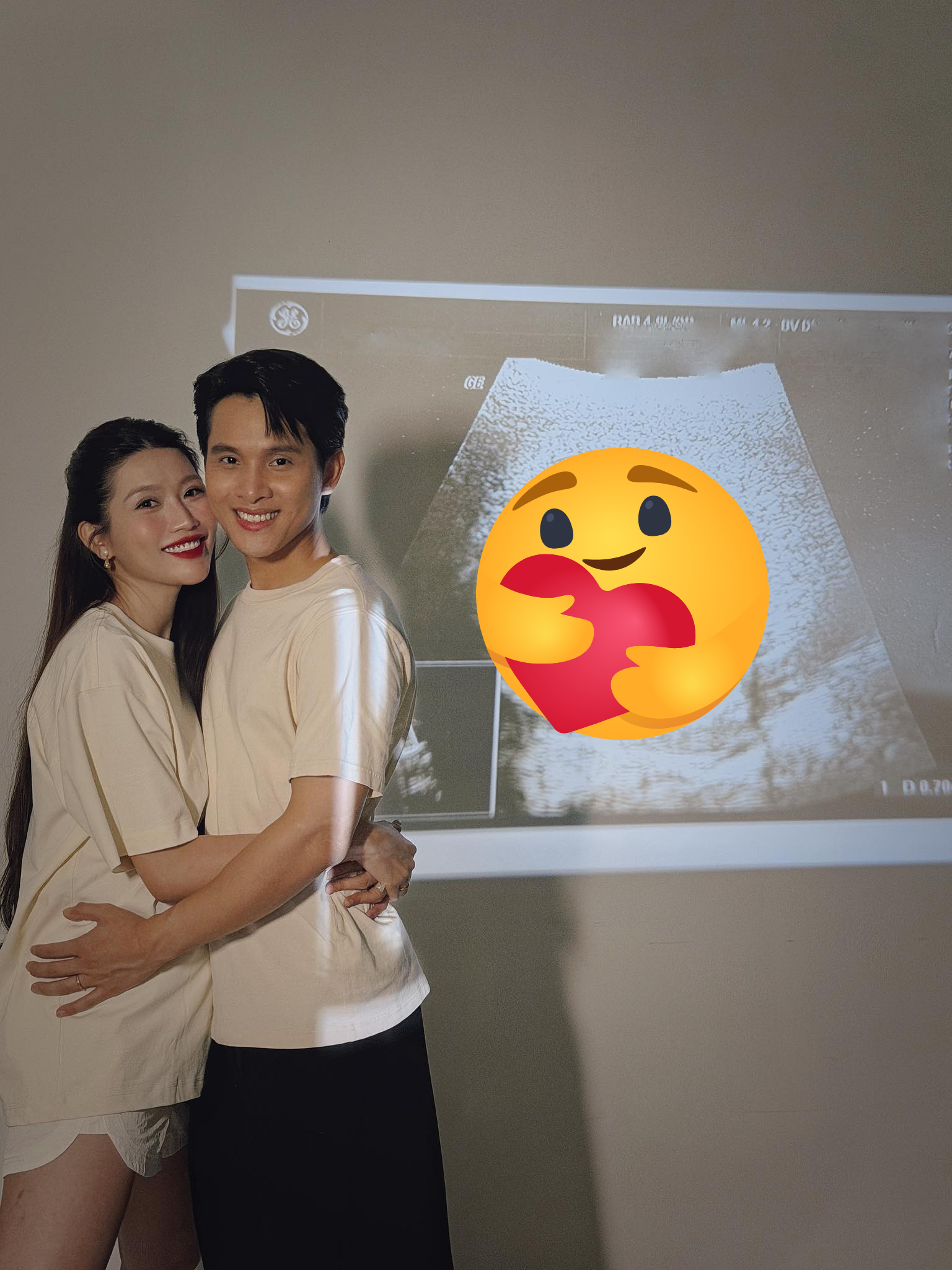 Choáng nhẹ: Chế Nguyễn Quỳnh Châu báo tin mang thai con đầu lòng chỉ hơn 1 tháng sau đám cưới – Tốc độ đúng kiểu ‘không đùa được đâu’