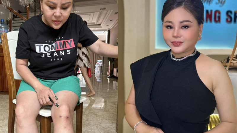 Diễn viên Lê Giang hé lộ tình trạng sức khỏe đáng lo: Chân đau teo cơ, từng hoảng sợ nghĩ đến cảnh bị liệt