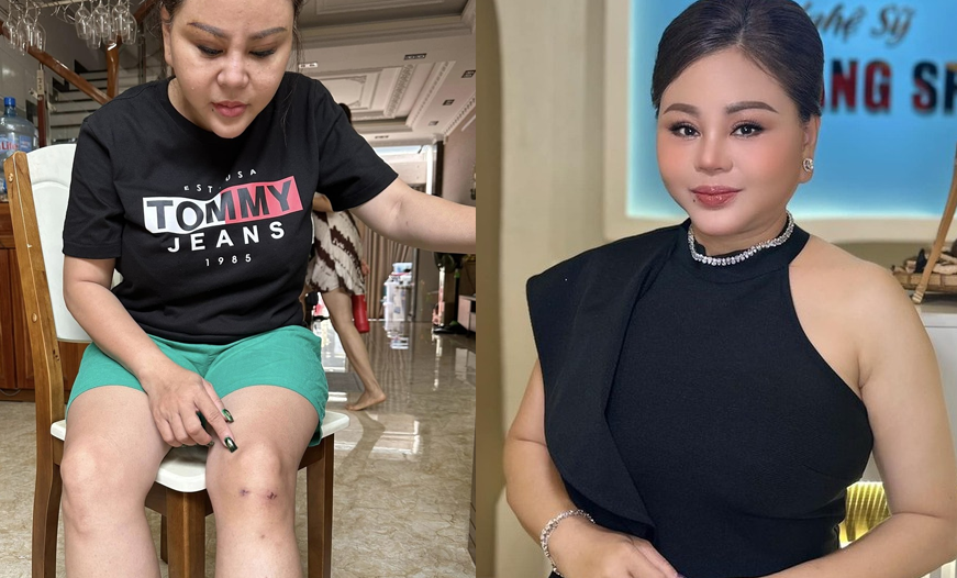 Diễn viên Lê Giang hé lộ tình trạng sức khỏe đáng lo: Chân đau teo cơ, từng hoảng sợ nghĩ đến cảnh bị liệt