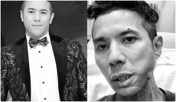 Kasim Hoàng Vũ đã qua đời ở tuổi 46: “Tiết lộ giây phút cuối đời của anh”