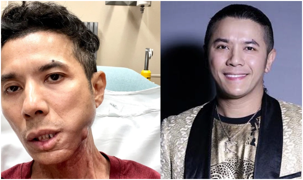 Ca sĩ Kasim Hoàng Vũ đã qua đời ở tuổi 46: Nhiều anh em nghệ sĩ