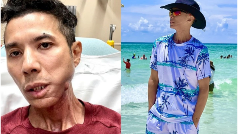 Đã rõ lý do Kasim Hoàng Vũ qu:a đ:ời: “Hóa ra là vì lý do này, thương anh quá, suốt bao nhiêu năm trời ch:ống ch:ọi”