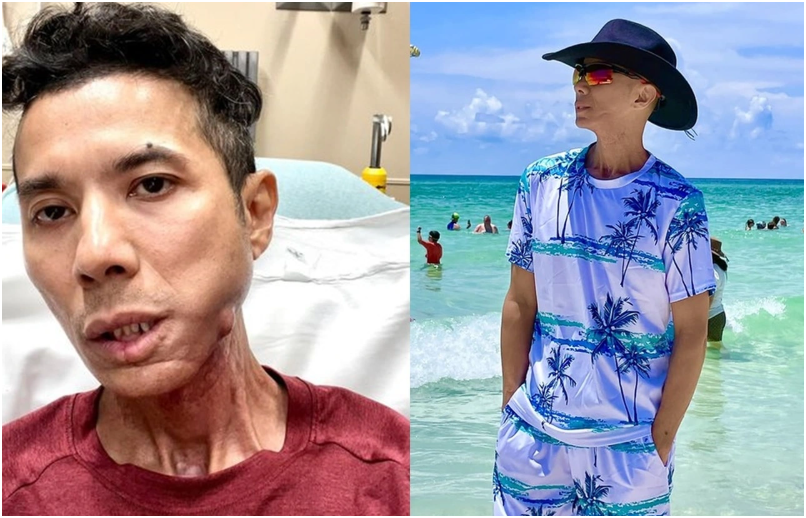 Đã rõ lý do Kasim Hoàng Vũ qu:a đ:ời: “Hóa ra là vì lý do này, thương anh quá, suốt bao nhiêu năm trời ch:ống ch:ọi”