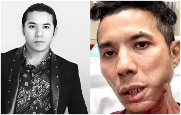 Rõ về căn bệ:nh của Kasim Hoàng Vũ trước khi m:ất: “Thương anh quá, anh đã phải chịu đa:u đớ:n nhiều rồi”