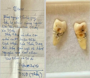 Cận cảnh 2 chiếc răng sâu Khầy tặng Tym: Được đem lên bàn thờ bái lạy mỗi ngày như bùa hộ mệnh, nhìn mà mắc ói luôn