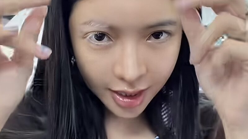 Sốc một mỹ nhân Việt mắc bệnh lạ cực hiếm chỉ 2% dân số thế giới gặp phải: Bác sĩ cũng phải bó tay!