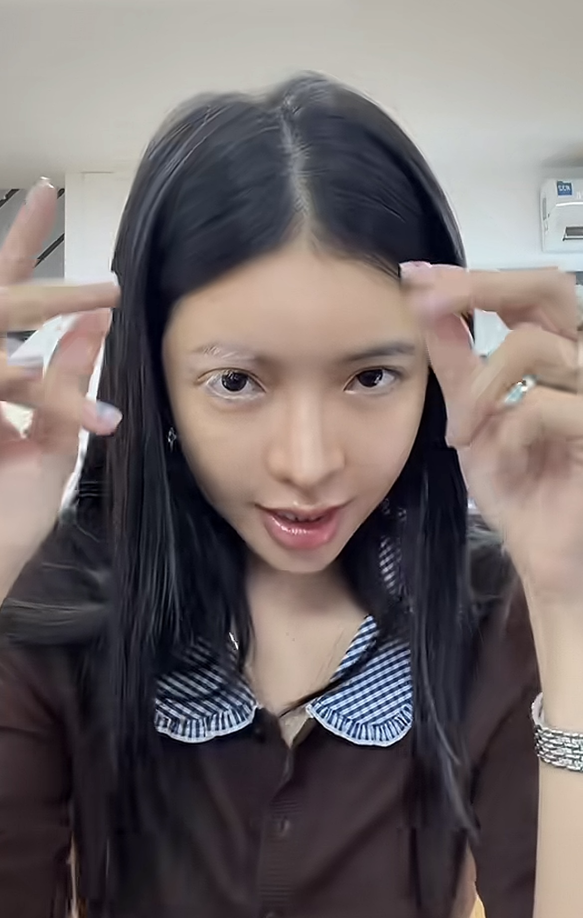 Sốc một mỹ nhân Việt mắc bệnh lạ cực hiếm chỉ 2% dân số thế giới gặp phải: Bác sĩ cũng phải bó tay!