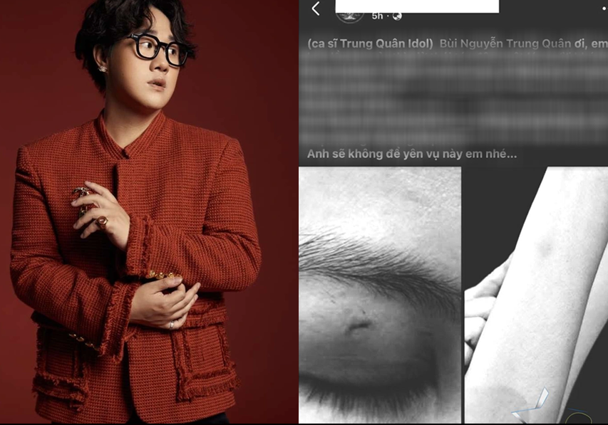 Ca sĩ Trung Quân Idol bất ngờ bị một người đàn ông réo tên vào vụ việc xôn xao MXH lúc này: ‘Anh sẽ không để yên vụ này đâu em nhé!’