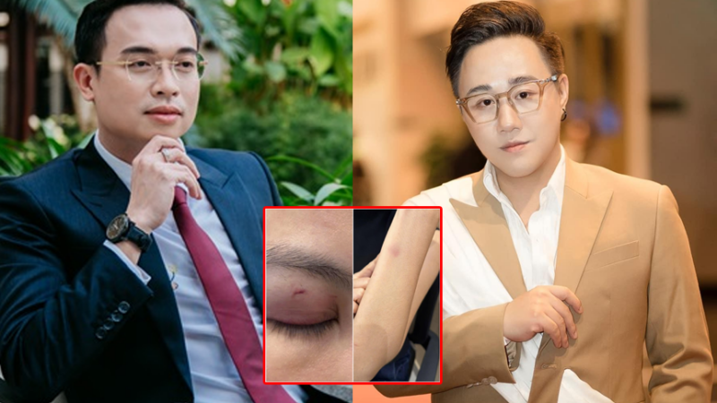 Rõ danh tính người đàn ông tố ca sĩ Trung Quân Idol hành hung vợ mình: Là bác sĩ có tên tuổi trong giới thẩm mỹ, vợ anh cũng không kém cạnh