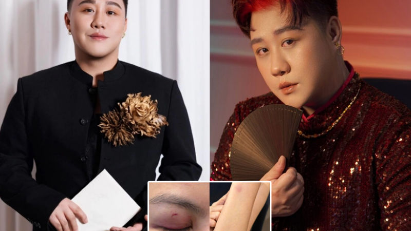 Giữa bão bị tố hành hung nữ bác sĩ, ca sĩ Trung Quân Idol có động thái mới gây tranh cãi: Đàn ông mà hèn quá!