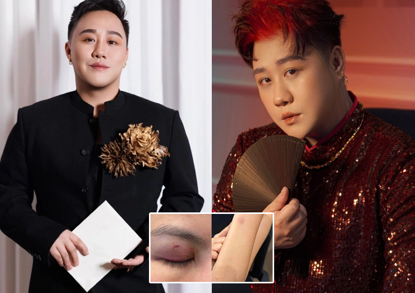 Giữa bão bị tố hành hung nữ bác sĩ, ca sĩ Trung Quân Idol có động thái mới gây tranh cãi: Đàn ông mà hèn quá!